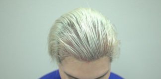 Любитель перекраивать внешность «Живой Кен» Родриго Алвес лысеет