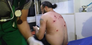 В Грузии в ходе протестов пострадали почти 70 человек