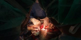 Российские врачи удалили две опухоли сразу