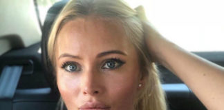 Дана Борисова рассказала, что сделала пластическую операцию по омоложению век