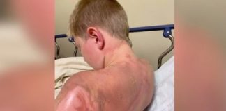 Мальчик окатил друга кипятком ради славы в сети