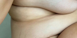 Тучная модель показала обнаженное тело и обрадовала фанатов