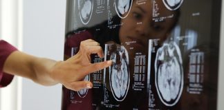 Ученые назвали причину снижения активности мозга и старения