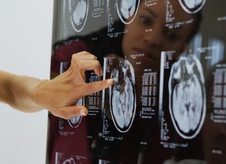 Ученые назвали причину снижения активности мозга и старения