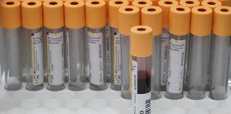 Ученые выявили категорию людей с наиболее высокими титрами антител к COVID-19