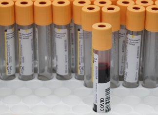 Ученые выявили категорию людей с наиболее высокими титрами антител к COVID-19