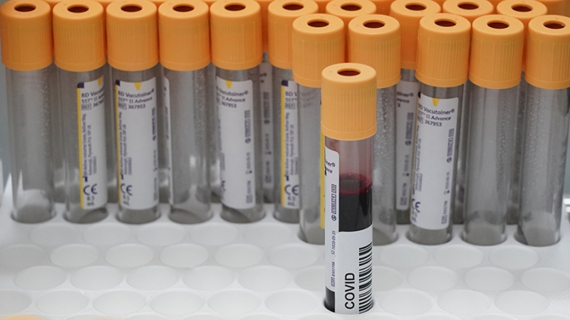 Ученые выявили категорию людей с наиболее высокими титрами антител к COVID-19