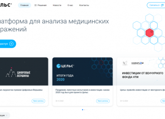 Цельс для анализа медицинских изображений: преимущества использования