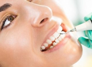 Ультразвуковая чистка зубов